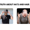 Does wearing a hat cause hair loss