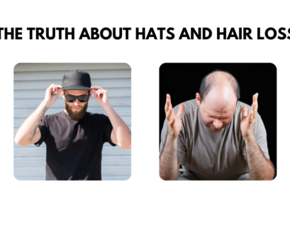 Does wearing a hat cause hair loss