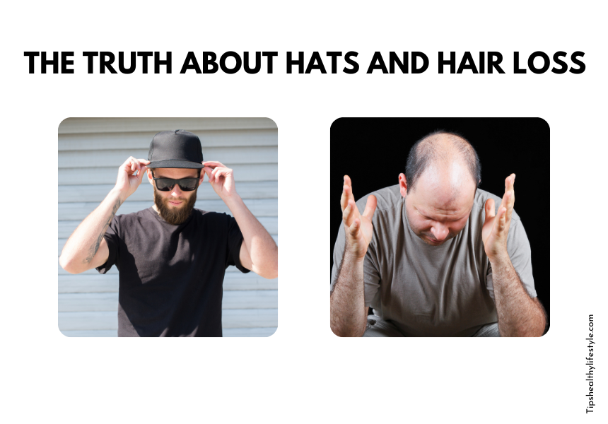 Does wearing a hat cause hair loss